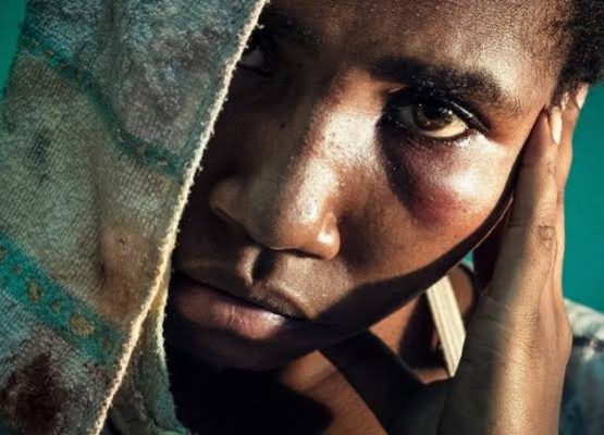 Gender Based Violence (GBV)/ Substance Abuse – (GBV/SA)